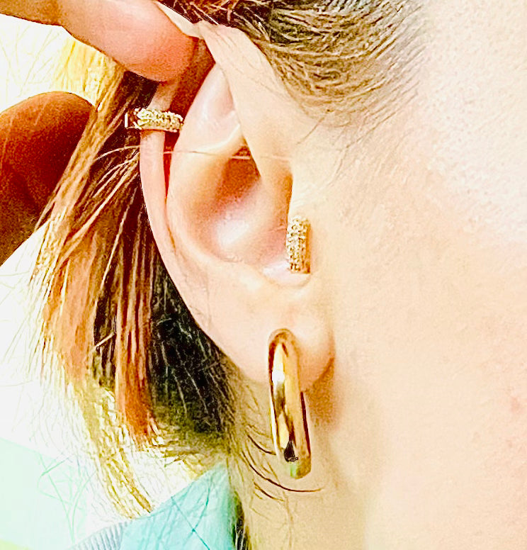 πΆassettoππβπ switched