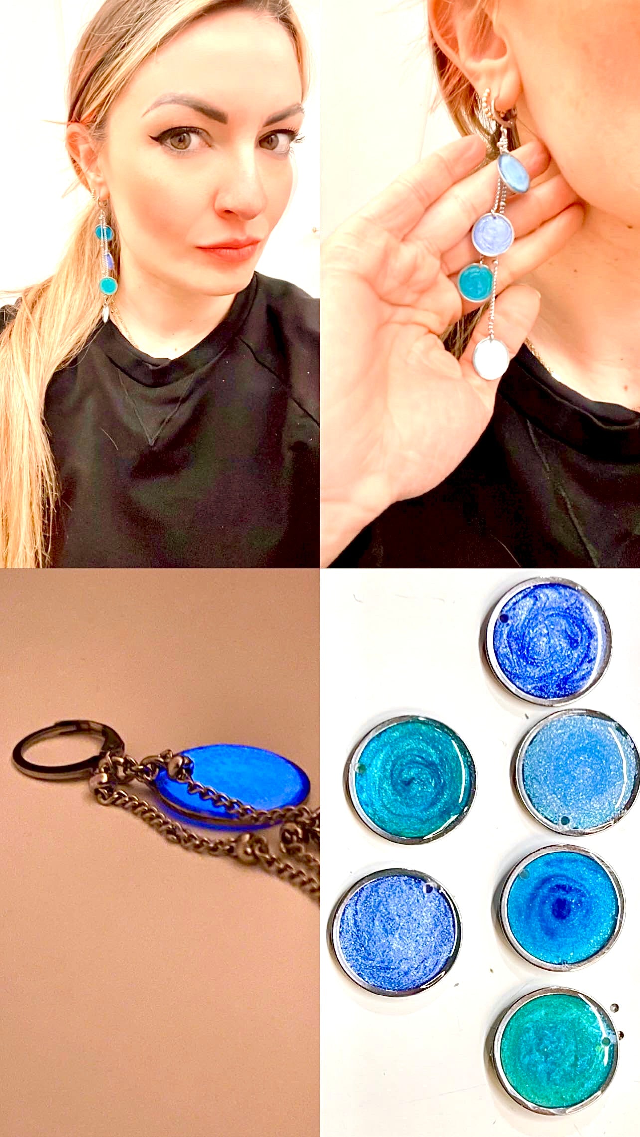 ππ’ππππedema